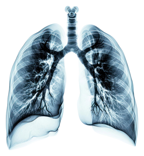 png-xray-picture-lungs-white-background-radiography-tomography